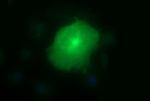 MMP13 Antibody in Immunocytochemistry (ICC/IF)