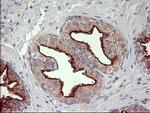 MMP13 Antibody in Immunohistochemistry (Paraffin) (IHC (P))