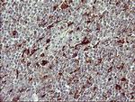 MMP13 Antibody in Immunohistochemistry (Paraffin) (IHC (P))