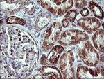 MMP13 Antibody in Immunohistochemistry (Paraffin) (IHC (P))