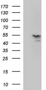 MMP13 Antibody in Western Blot (WB)