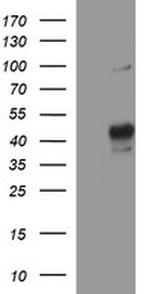 MMP13 Antibody in Western Blot (WB)