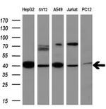 MMP13 Antibody in Western Blot (WB)