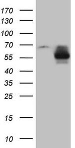 MMP3 Antibody in Western Blot (WB)