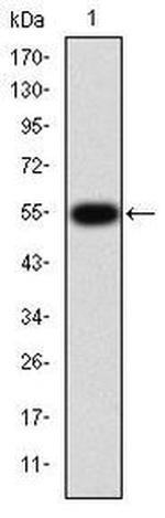 MMP9 Antibody in Western Blot (WB)