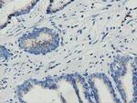MOBKL1A Antibody in Immunohistochemistry (Paraffin) (IHC (P))