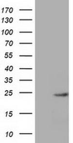 MOBKL1A Antibody in Western Blot (WB)