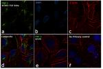 PAI1 Antibody in Immunocytochemistry (ICC/IF)