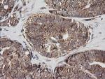 MRPS34 Antibody in Immunohistochemistry (Paraffin) (IHC (P))