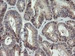 MRPS34 Antibody in Immunohistochemistry (Paraffin) (IHC (P))