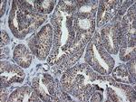 MRPS34 Antibody in Immunohistochemistry (Paraffin) (IHC (P))