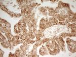 MRRF Antibody in Immunohistochemistry (Paraffin) (IHC (P))