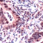 MSH3 Antibody in Immunohistochemistry (Paraffin) (IHC (P))