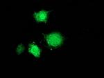 MSI1 Antibody in Immunocytochemistry (ICC/IF)