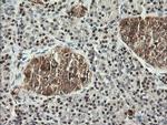 MSI1 Antibody in Immunohistochemistry (Paraffin) (IHC (P))