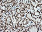 MSI1 Antibody in Immunohistochemistry (Paraffin) (IHC (P))