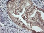 MSI1 Antibody in Immunohistochemistry (Paraffin) (IHC (P))