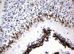 MSI1 Antibody in Immunohistochemistry (Paraffin) (IHC (P))