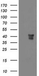 MSI1 Antibody in Western Blot (WB)