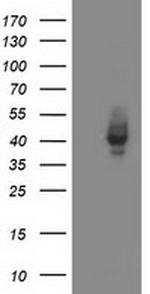 MSI1 Antibody in Western Blot (WB)