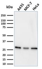 Myofibroblast Marker Antibody in Western Blot (WB)