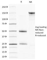 Actin, Muscle Specific (Muscle Cell Marker) Antibody in SDS-PAGE (SDS-PAGE)