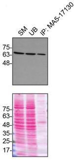 Moesin Antibody in Immunoprecipitation (IP)