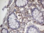 MTDH Antibody in Immunohistochemistry (Paraffin) (IHC (P))