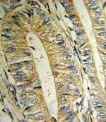 MTHFD2 Antibody in Immunohistochemistry (IHC)