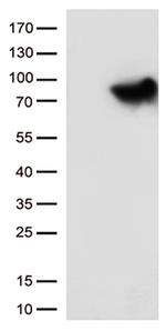 MTHFR Antibody in Western Blot (WB)