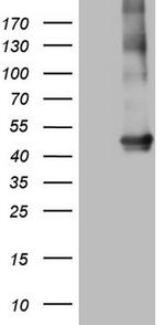 MTOR Antibody in Western Blot (WB)