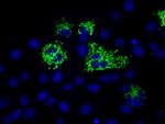 MTRF1L Antibody in Immunocytochemistry (ICC/IF)