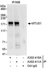 MTUS1 Antibody in Immunoprecipitation (IP)
