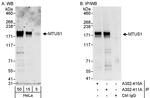 MTUS1 Antibody in Western Blot (WB)