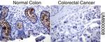 MUC1 Antibody in Immunohistochemistry (Paraffin) (IHC (P))