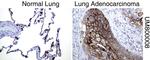 MUC1 Antibody in Immunohistochemistry (Paraffin) (IHC (P))