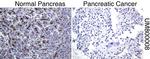 MUC1 Antibody in Immunohistochemistry (Paraffin) (IHC (P))