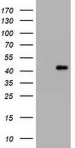 MUC16 Antibody in Western Blot (WB)