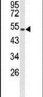 MUTYH Antibody in Western Blot (WB)