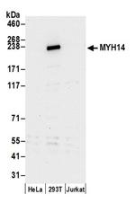 MYH14/Myosin-14 Antibody in Western Blot (WB)