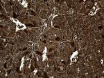 MYL1 Antibody in Immunohistochemistry (Paraffin) (IHC (P))