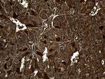 MYL1 Antibody in Immunohistochemistry (Paraffin) (IHC (P))