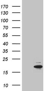 MYL1 Antibody in Western Blot (WB)