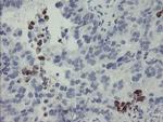 MYL7 Antibody in Immunohistochemistry (Paraffin) (IHC (P))