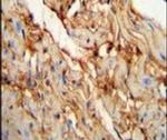 MYOZ1 Antibody in Immunohistochemistry (IHC)