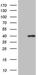 MYOZ1 Monoclonal Antibody (OTI2A2) (TA808941)