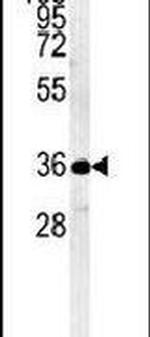 MYOZ1 Antibody in Western Blot (WB)