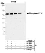 Matriptase/ST14 Antibody in Western Blot (WB)