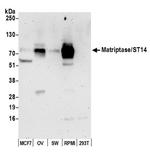 Matriptase/ST14 Antibody in Western Blot (WB)