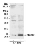 MnSOD Antibody in Western Blot (WB)